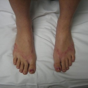 A person 's feet are shown on top of a bed.