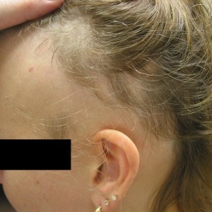 A woman with her head shaved and ear piercing.