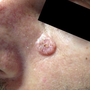 A close up of the skin on a person 's face