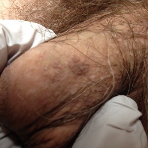 A close up of the hair on a man 's arm