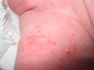 A close up of the skin on someones arm