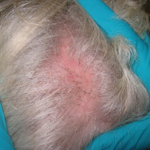 Brown dots are nits and lice