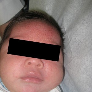 A baby with black eyes and a black face