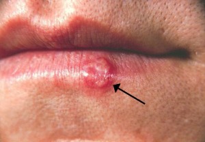 A close up of the lip with an arrow pointing to it.