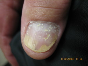A person with yellow and white nail polish on their fingertip.