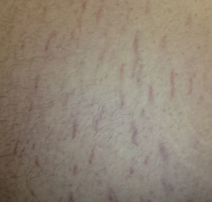 A close up of the skin on someones body