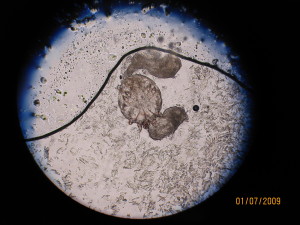 Scabies mite in skin scrapings under microscope